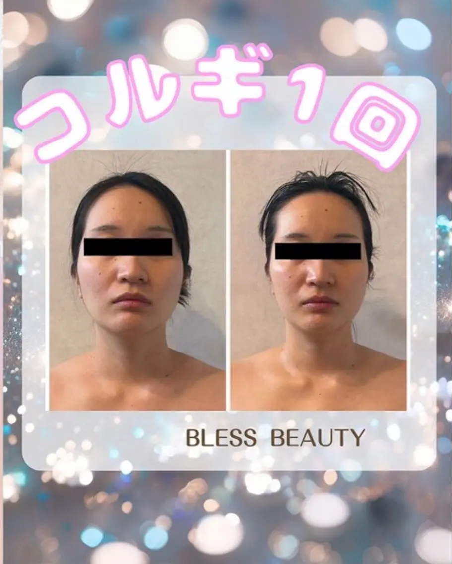 《究極の華奢みえ》最新コルギ・肩甲骨はがし・デコルテ・パック付きで大満足の写真