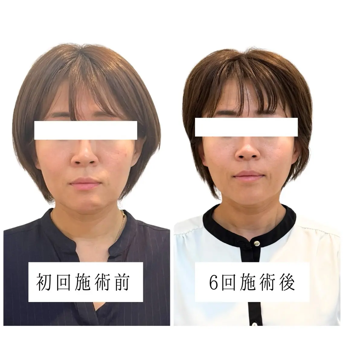 コアの木整骨院高津院 藤内尚志のエステ・リラクイメージ