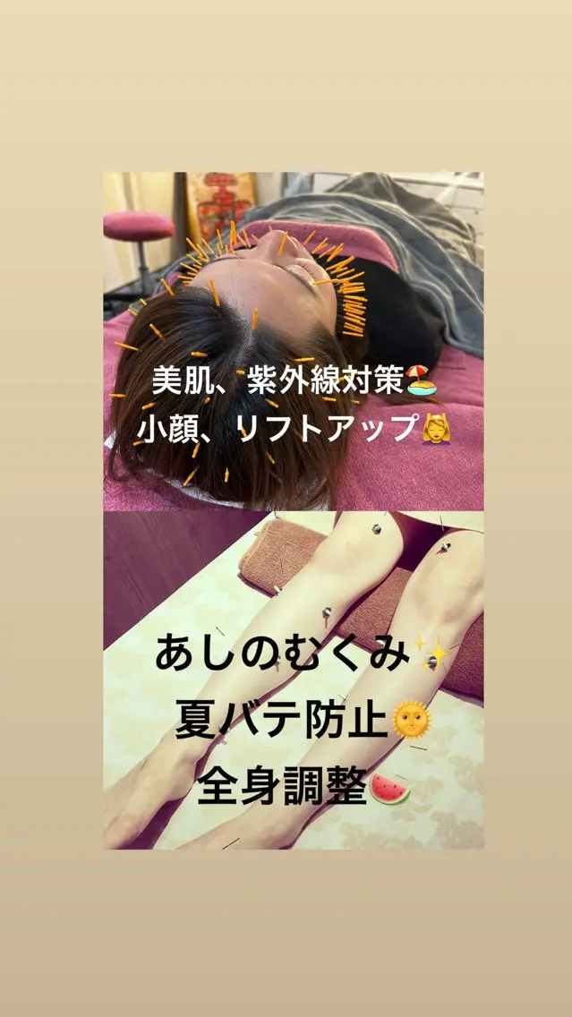 🏖️期間限定🍉夏バテ対策💆♀️プラチナコース〜心身ともに美しく💖の写真