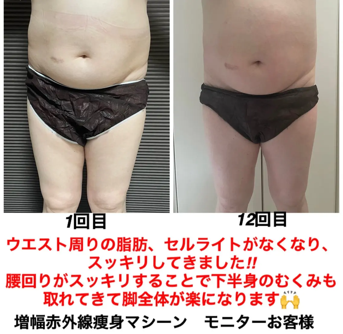 ネイル・エステサロン UILANIのエステ・リラクイメージ