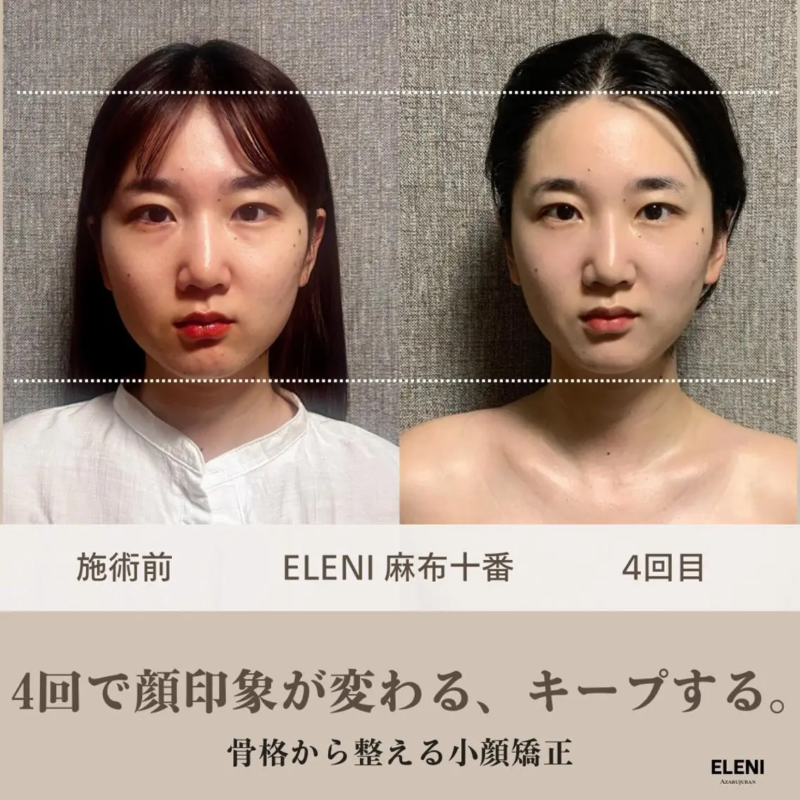 ✨おすすめ✨小顔×姿勢×全身ケア｜トータル美容整体150分🍀口コミで10分延長🎁麻布十番プライベートサロンの写真