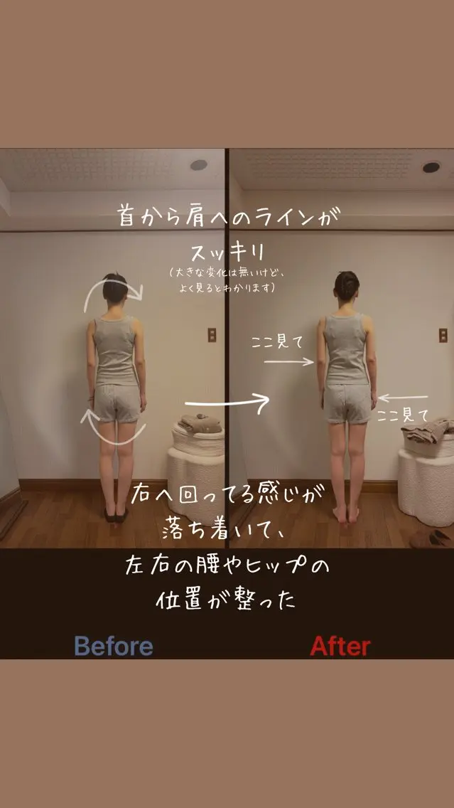 肩こり・巻き肩・姿勢 ・小顔｜大阪西区のエステ・リラクイメージ
