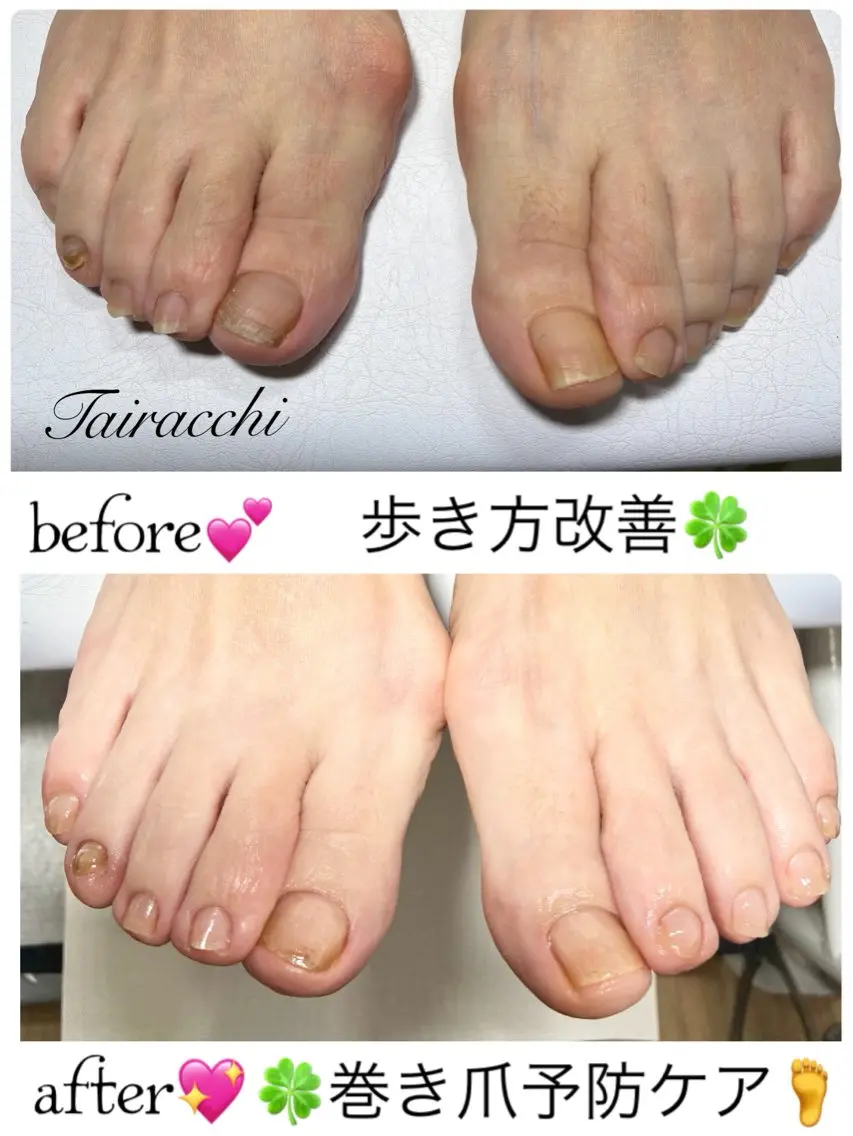 ネイル フットネイル フットネイル Tairacchi タイラッチのエステ・リラクイメージ