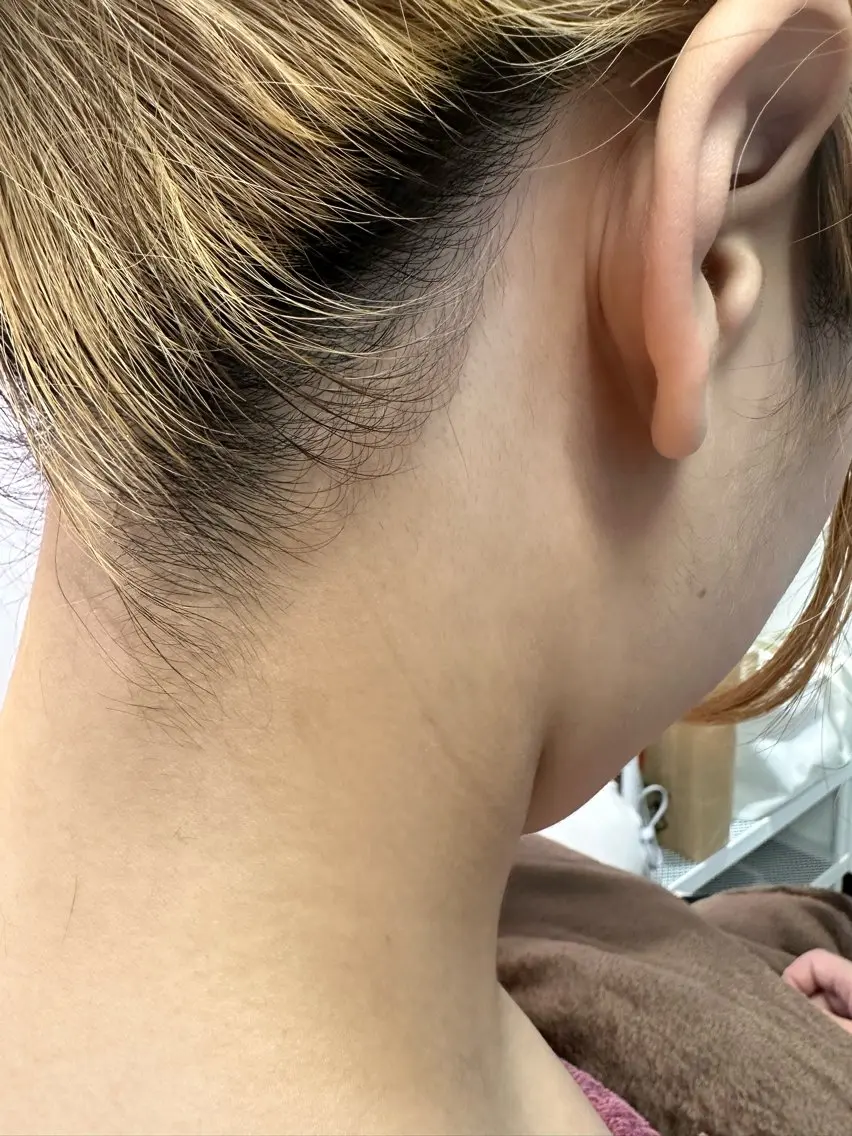 ミニモ学割　２０歳＆卒業生限定✨お顔シェービング＋拭き取りパック＋うなじシェービングの写真