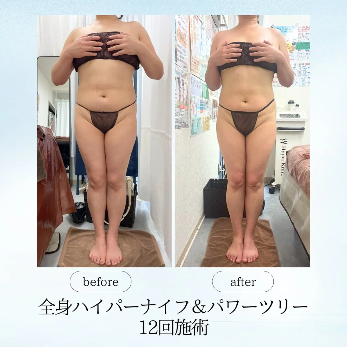 エステ リラク 《痩身、小顔専門店》 エスプレッソのエステ・リラクイメージ