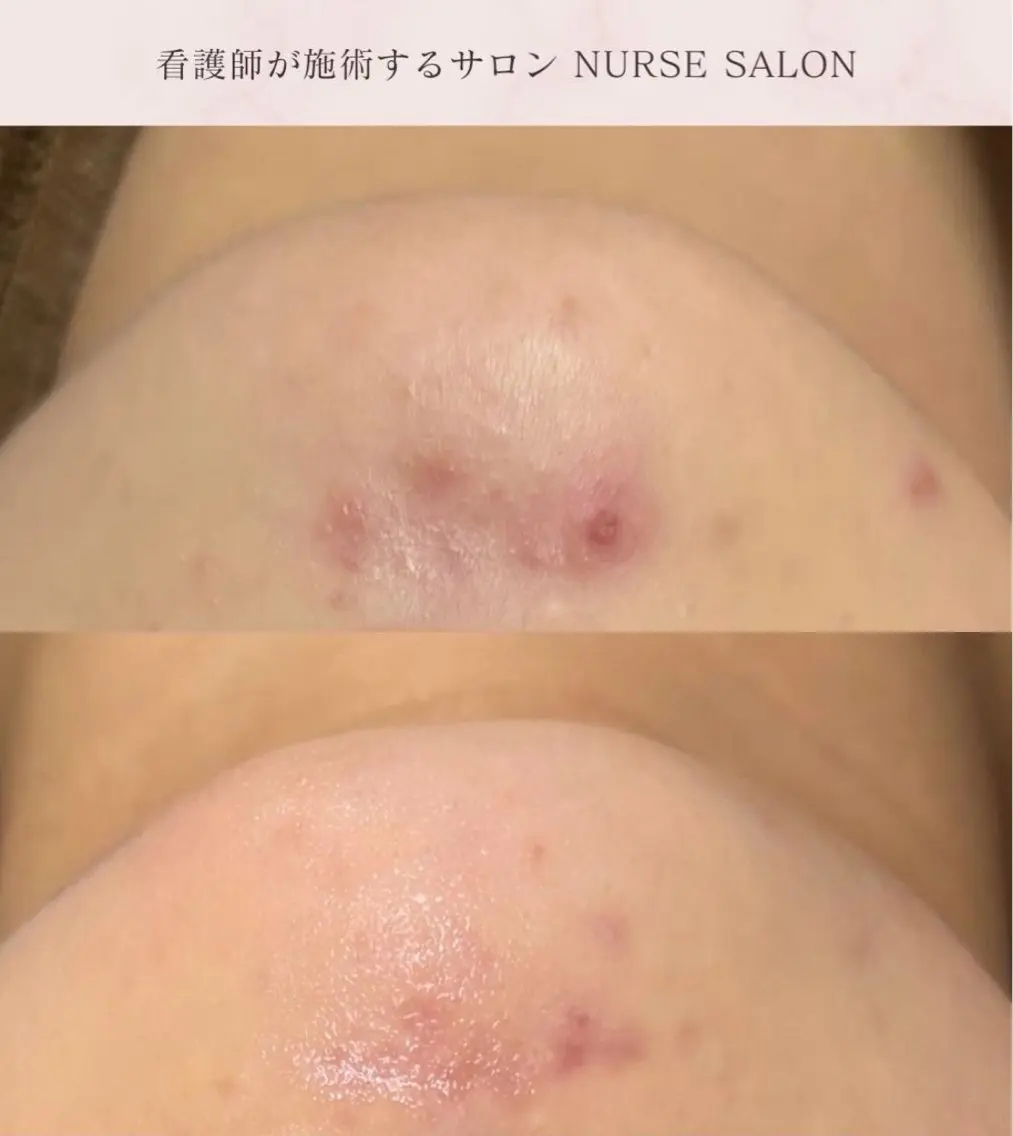 ナスサロ Reikaのエステ・リラクイメージ