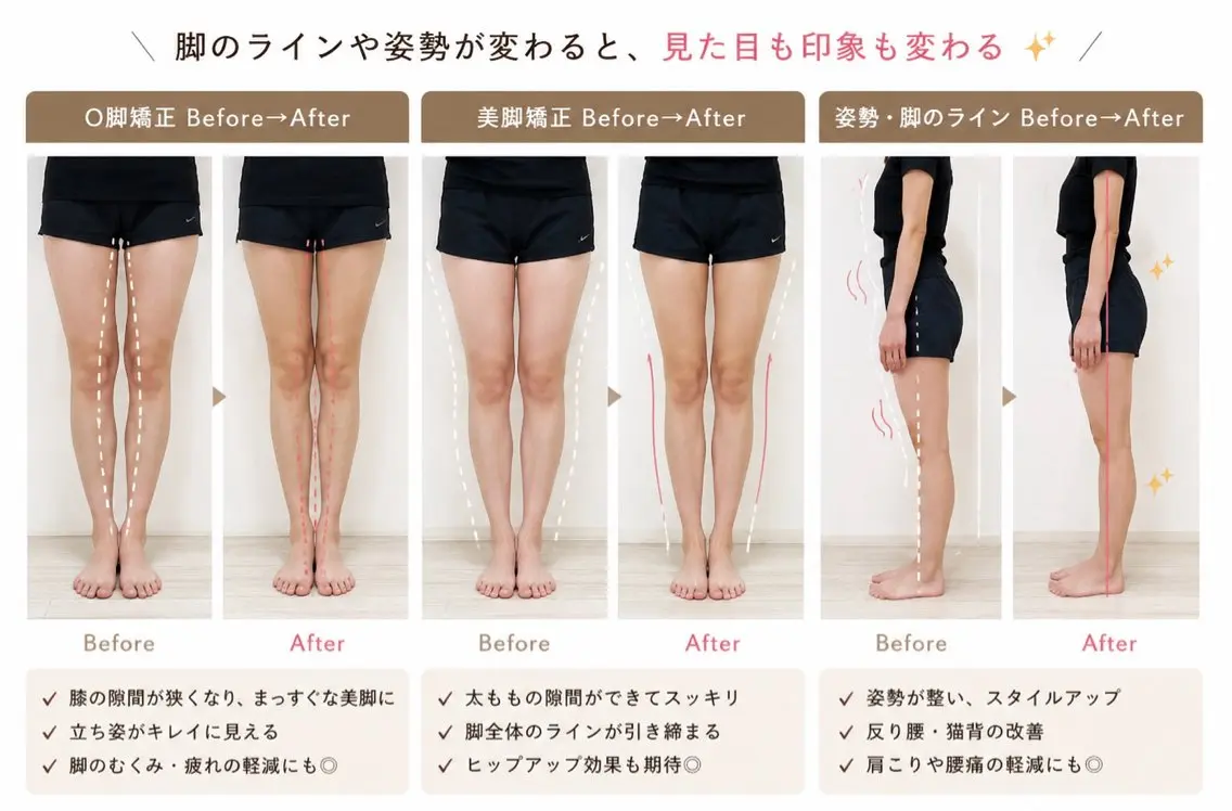 美脚骨盤矯正コース(脚をスッキリ、お尻周りをスッキリ・産後の骨盤矯正したい方・O脚、X脚が気になる方にオススメ)の写真