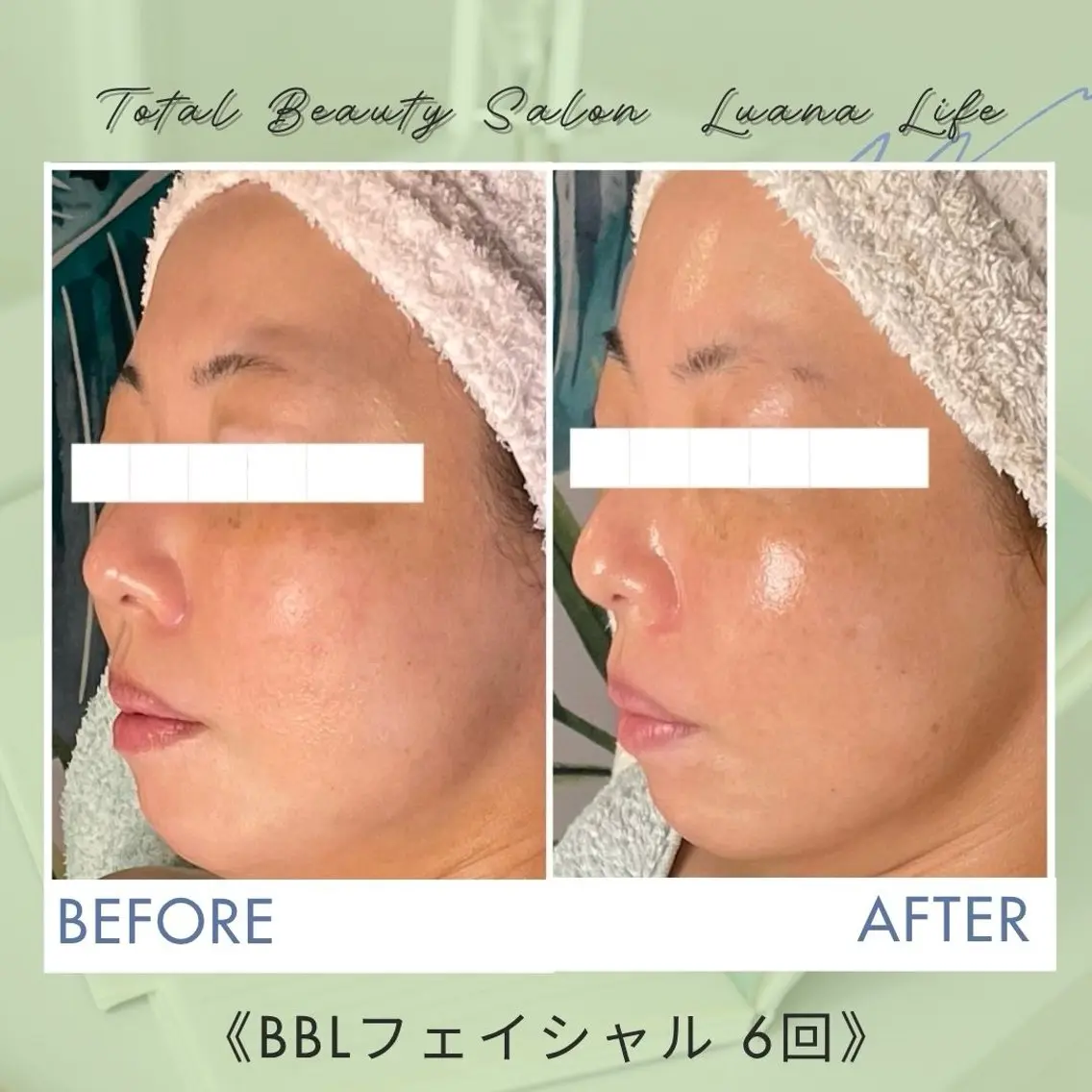 －5歳肌✨️肌質改善 LuanaLifeのエステ・リラクイメージ