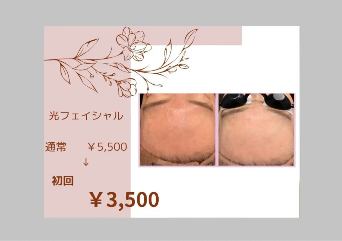 【光フェイシャル】おためしコース3周打ち(20分)の写真