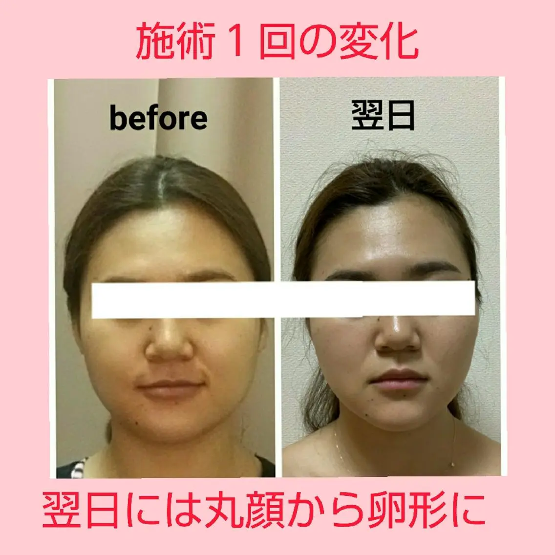 小顔 美肌専門 Matoriaのエステ・リラクイメージ
