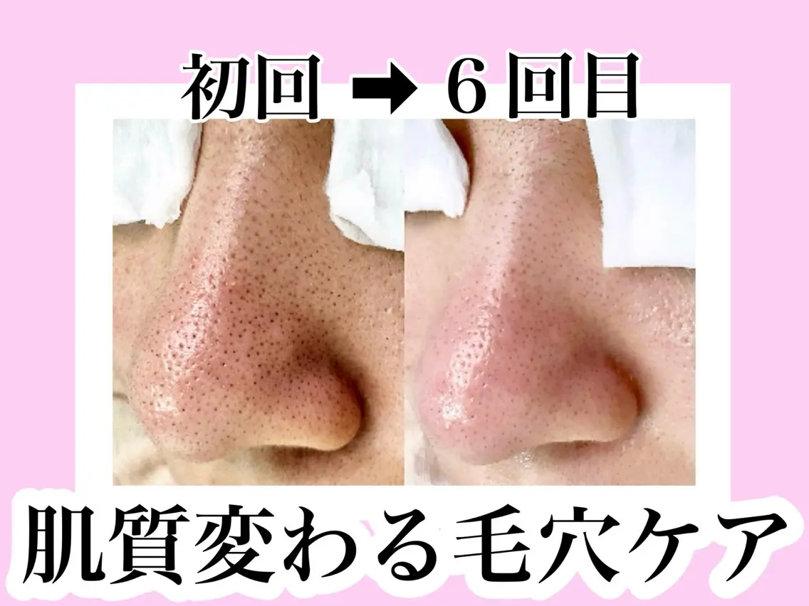 医療提携美容サロン Beatriceのエステ・リラクイメージ