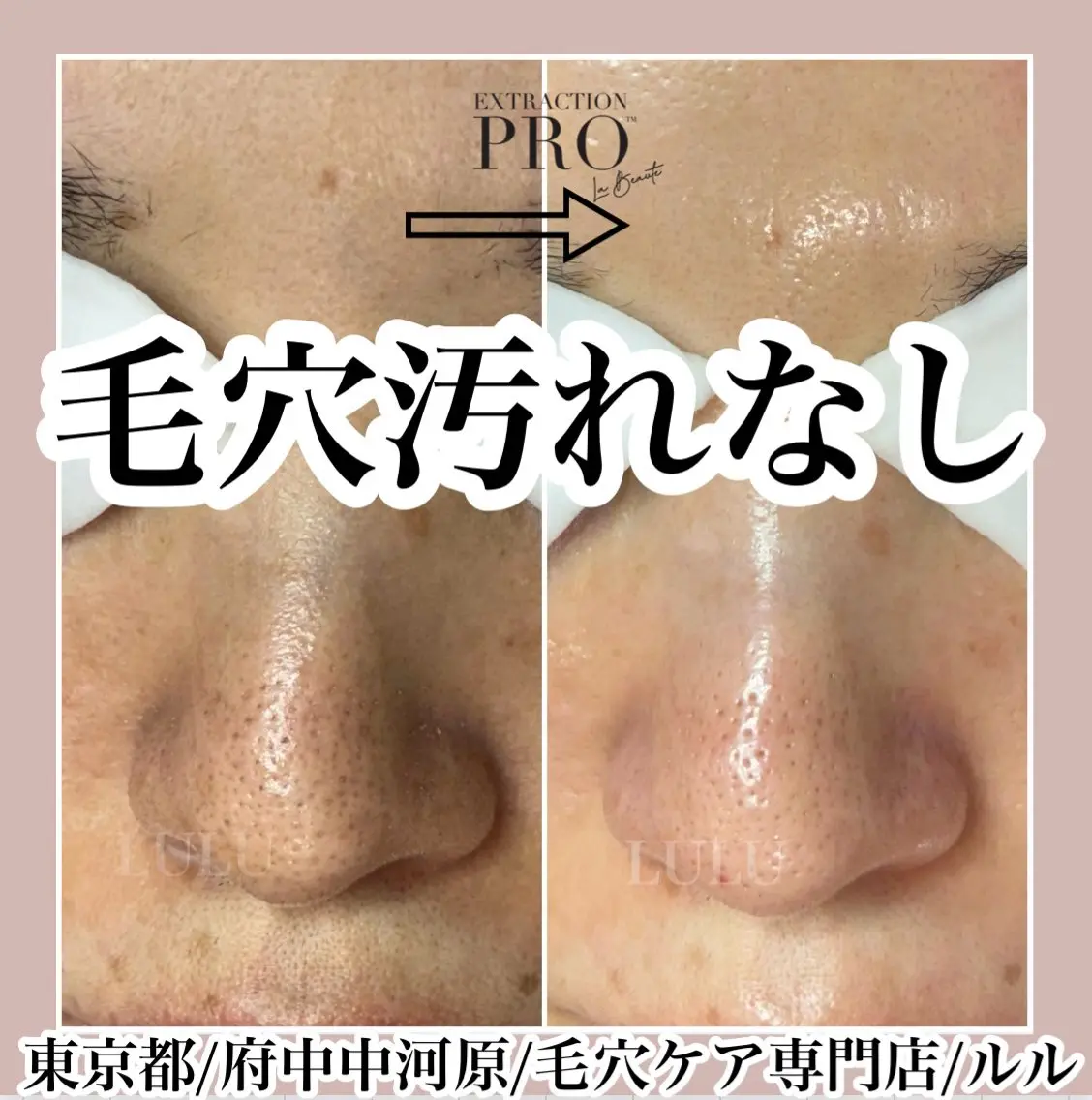 その他 LULU ルルのエステ・リラクイメージ