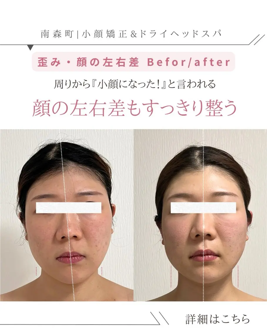 ドライヘッドスパ 専門店SIESTAのエステ・リラクイメージ