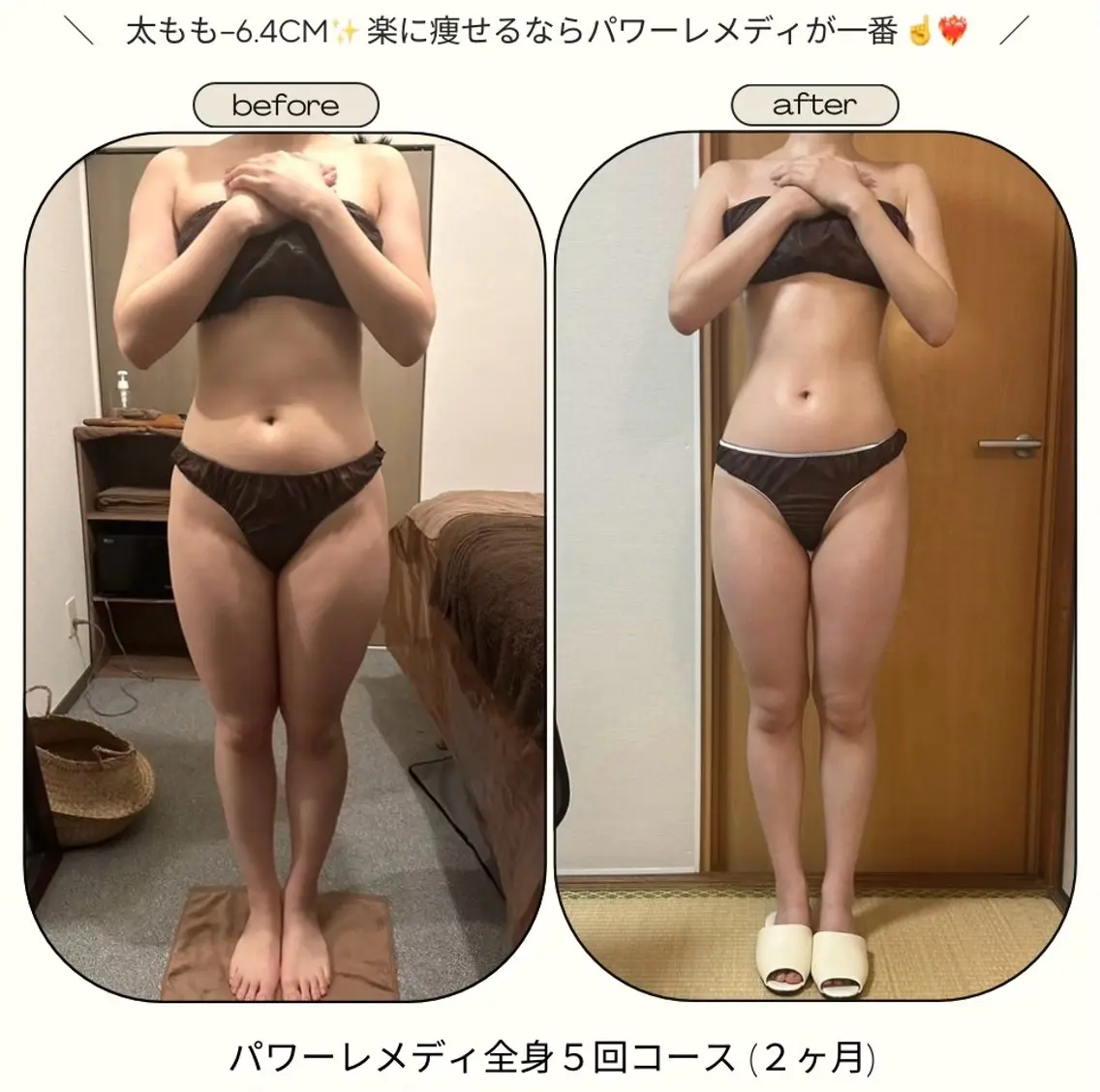 《本気痩せ×疲労改善 》  BILOOPのエステ・リラクイメージ