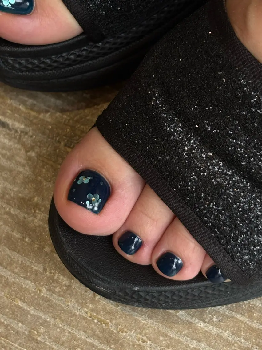 ネイル フットネイル nail [yui]のネイルデザイン