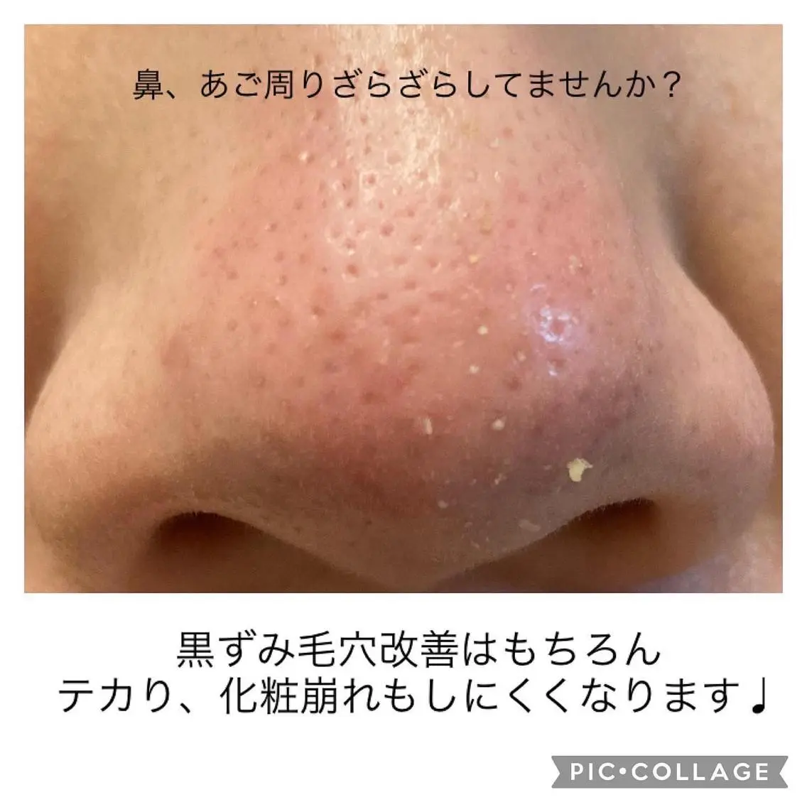 その他 毛穴ケア・肌質改善 徳川のエステ・リラクイメージ