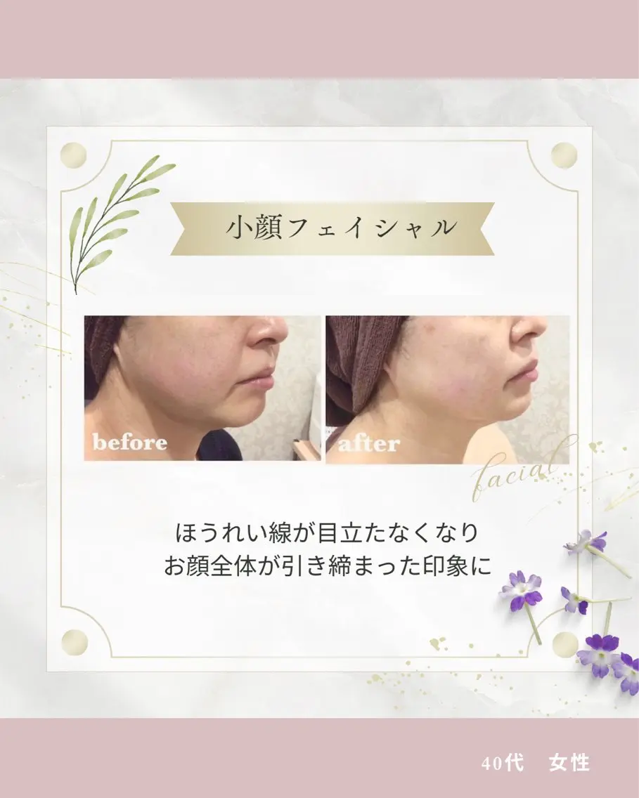 エステ 《 肌質×美肌 》 addissimoのエステ・リラクイメージ