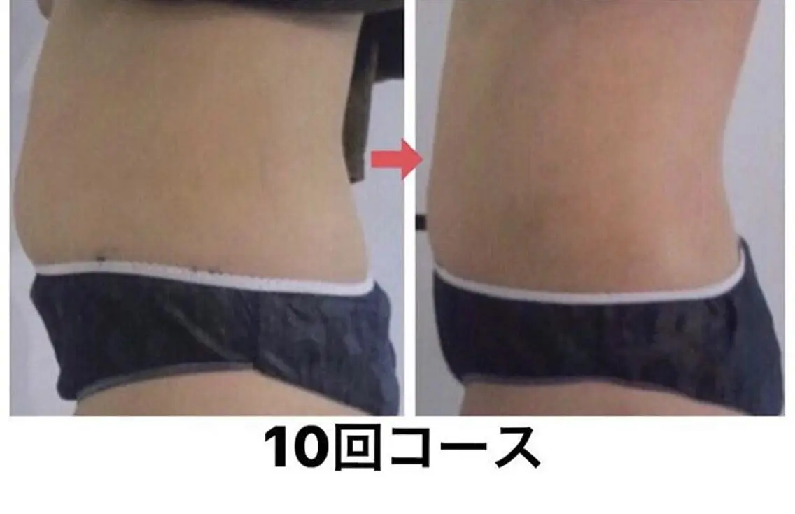 横浜エステサロン R-ing リングのエステ・リラクイメージ