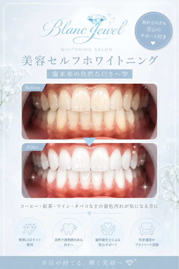 美容セルフホワイトニングの写真