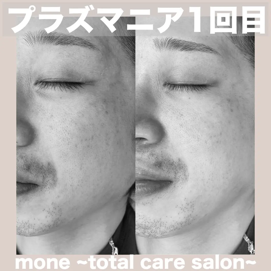 エステ mone (モーネ)のエステ・リラクイメージ