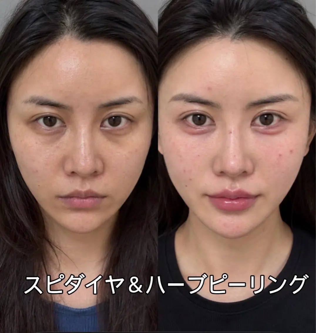 エステ JUNA 健康美サロン渋谷店のエステ・リラクイメージ