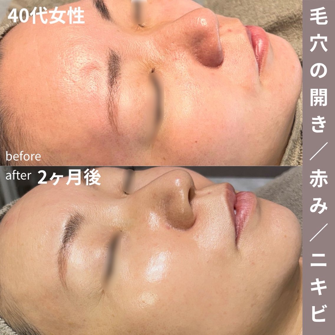 毛穴／肌管理サロン B SKINのエステ・リラクイメージ
