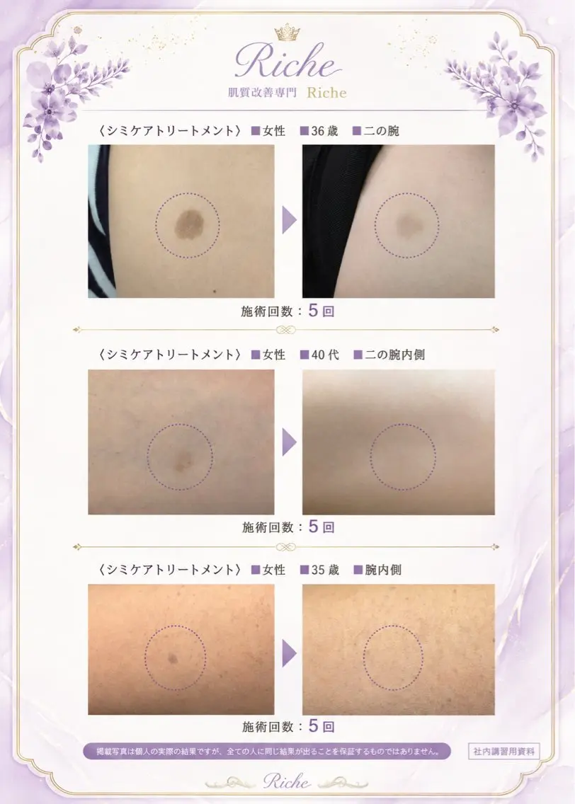 エステ 中摩 美命のエステ・リラクイメージ