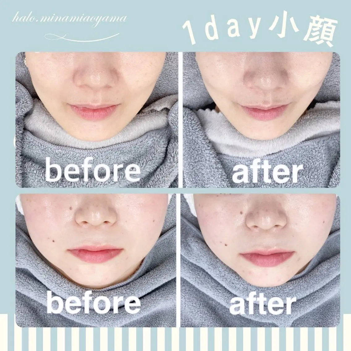 【60分】痛くない1day小顔選べるフェイシャル【ミニモ限定】の写真