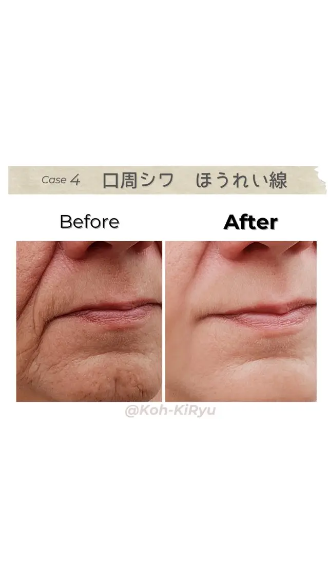 その他 体質改善✨美肌育サロ ン　香嬉琉🌿きよかのエステ・リラクイメージ