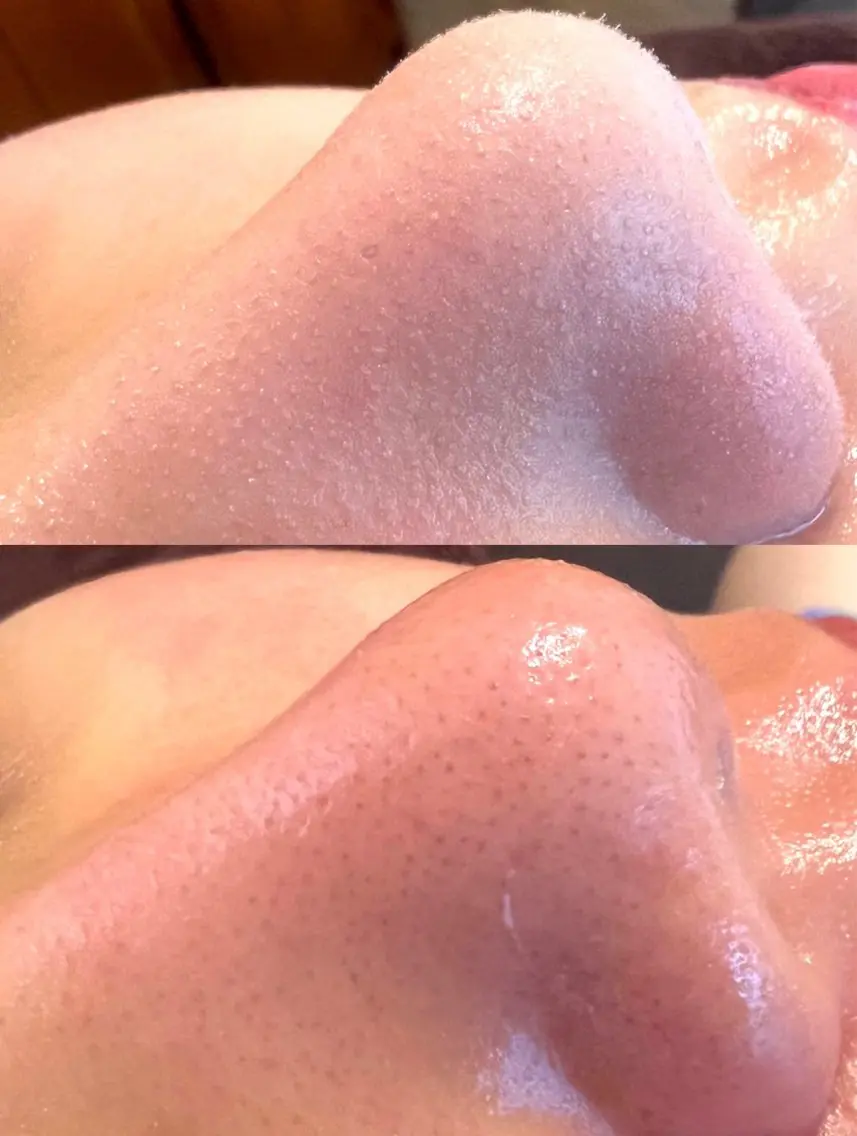 艶肌wax®︎ shocoのエステ・リラクイメージ