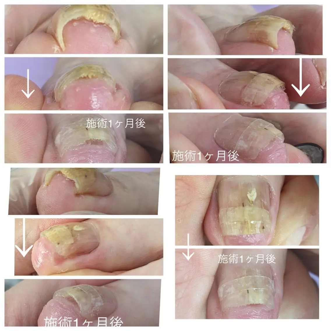 ネイル 和賀井 恵理のネイルデザイン