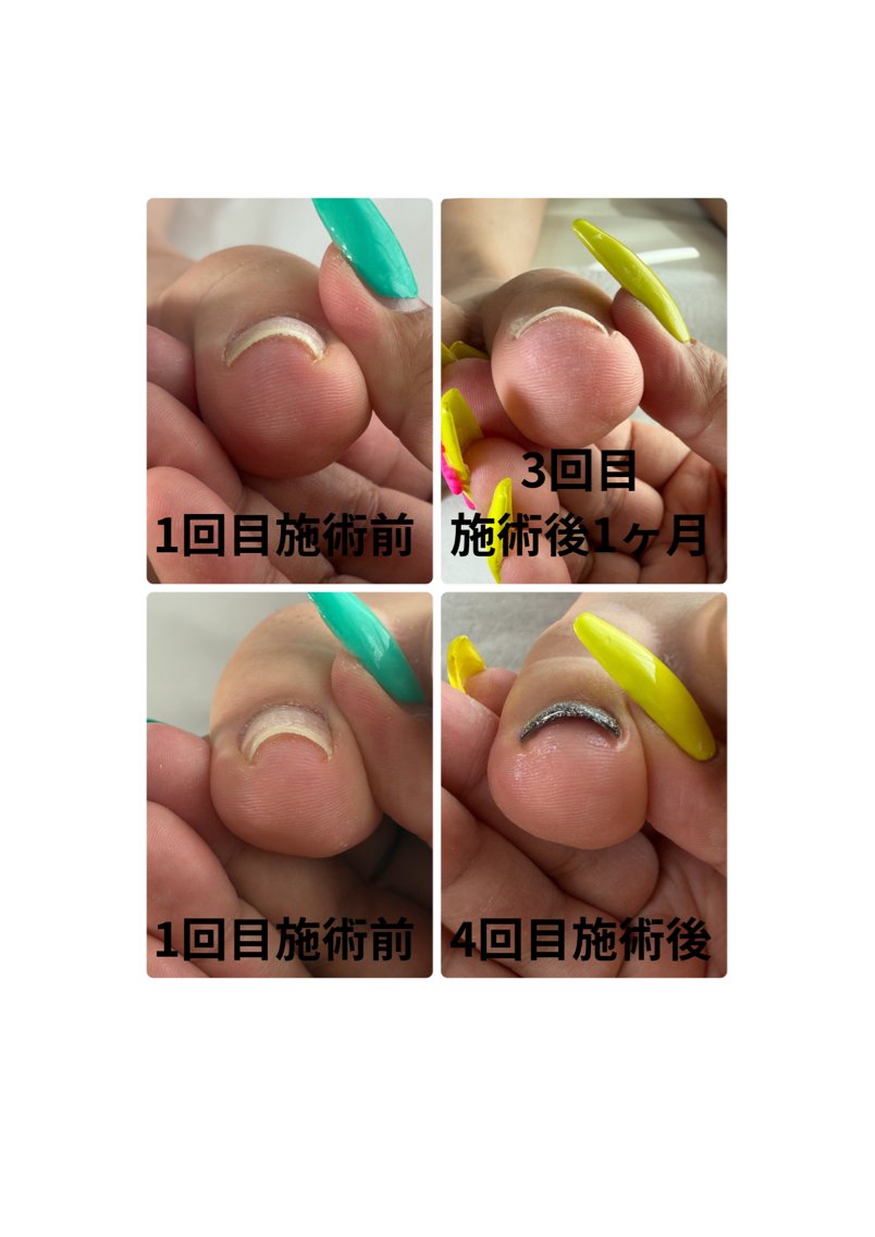 ネイル フットネイル Nona NAILのネイルデザイン