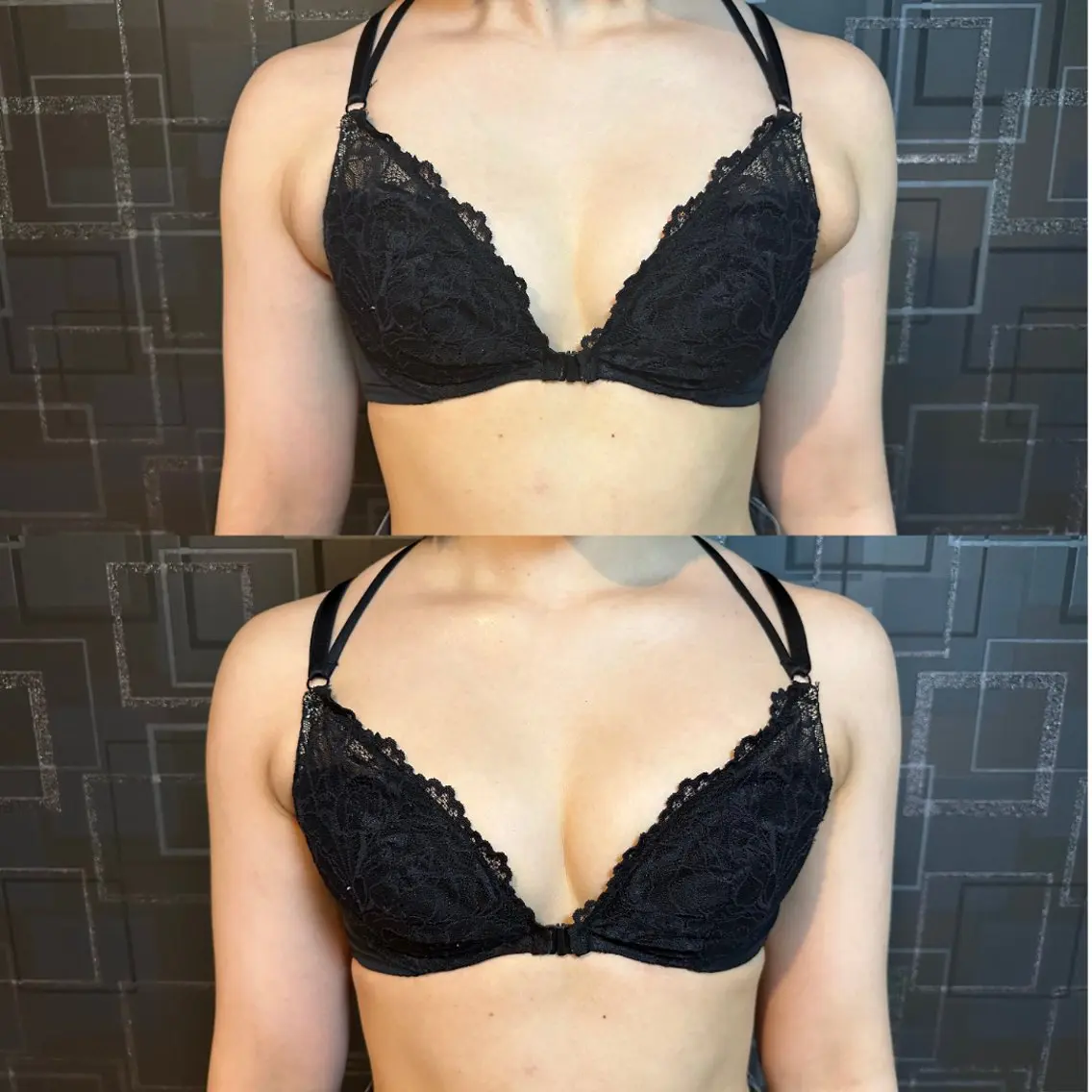 【肩凝り・背中凝り重視】美乳を創るバストケア施術(上半身)の写真