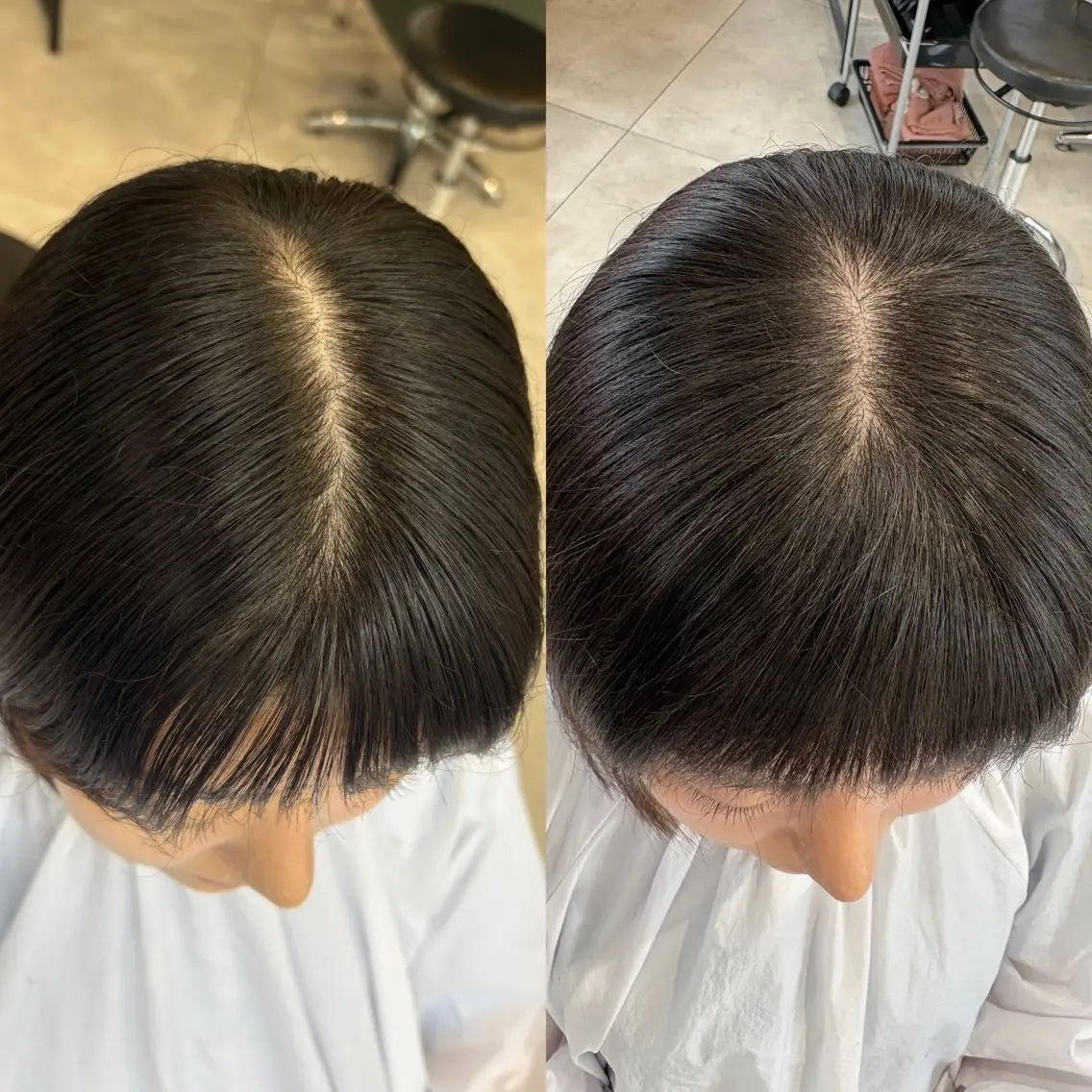 ⭐️生えぐせ改善 ヘアリセッター✂️のヘアスタイル