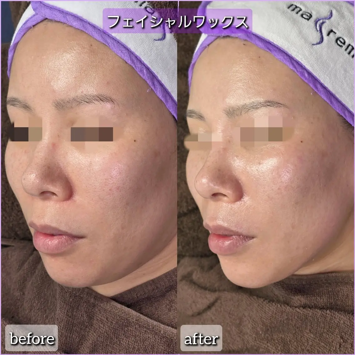 エステ salon Lilyのエステ・リラクイメージ