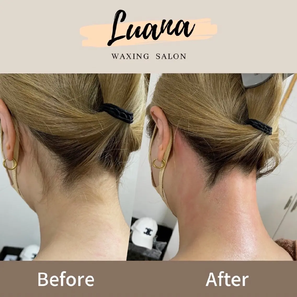 脱毛 Luana wax 🐚根本のエステ・リラクイメージ