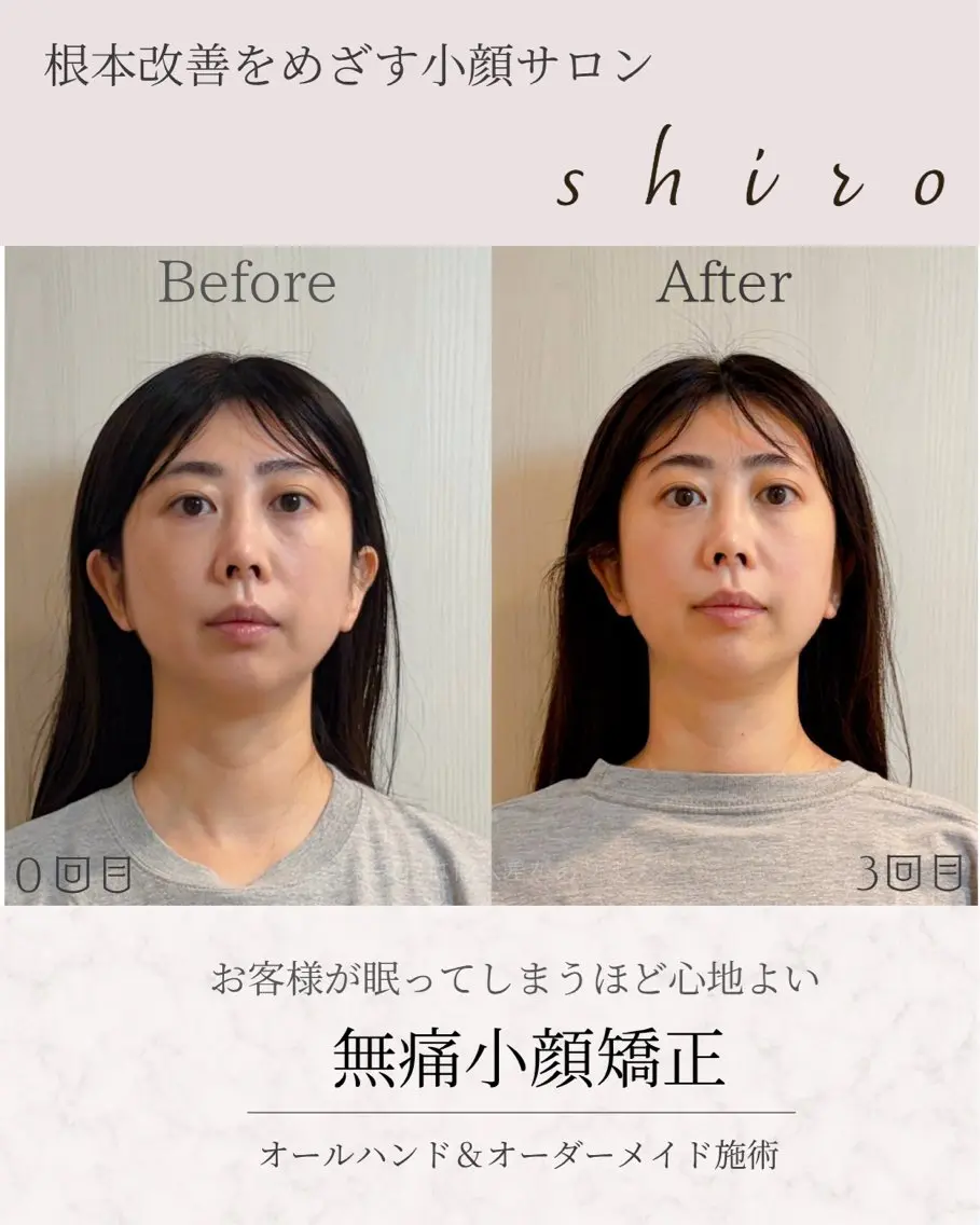 エステ リラク 小顔矯正勝山式 shiroしろのその他イメージ