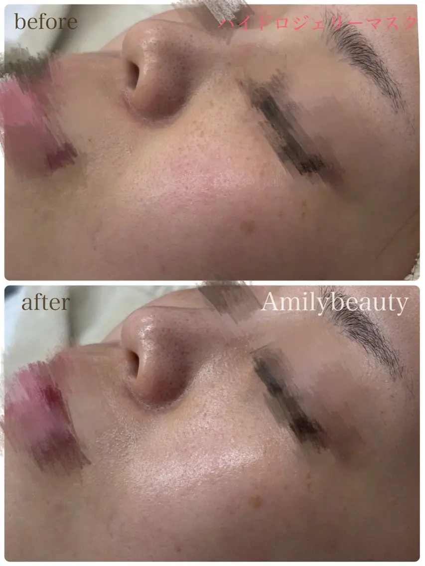 Amily beauty 毛利のその他イメージ