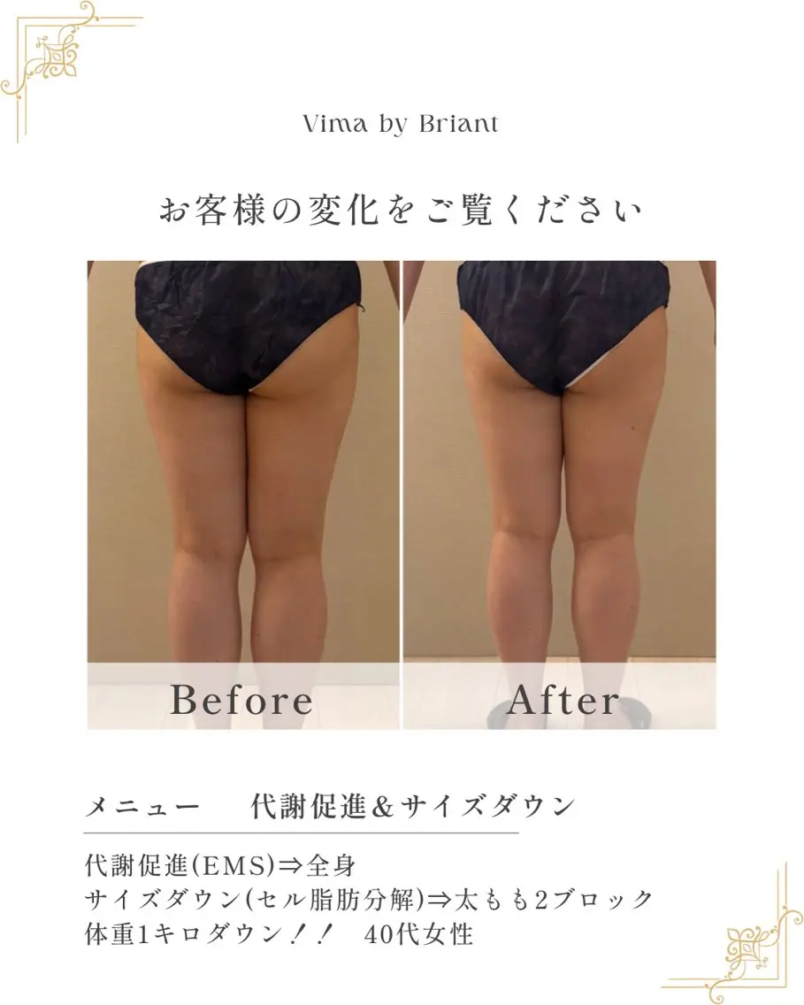 【代謝促進EMS+実用新案技術サイズダウン3パーツ】モニター/当サロンはセル脂肪✨️燃焼実用新案機器を使用しておりますの写真