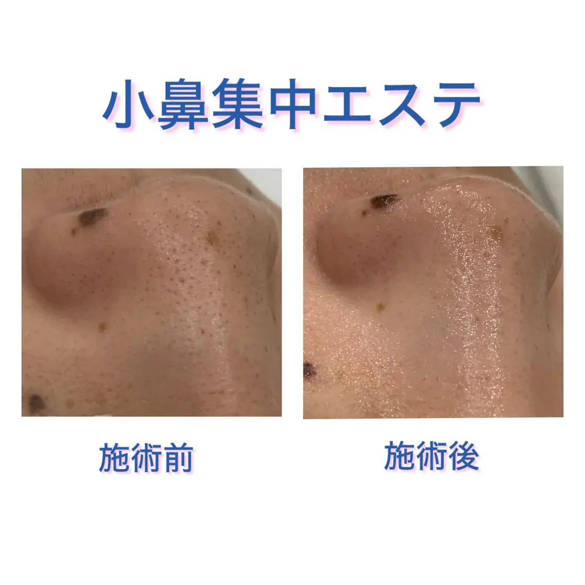 碇(安原) 菜々子のエステ・リラクイメージ