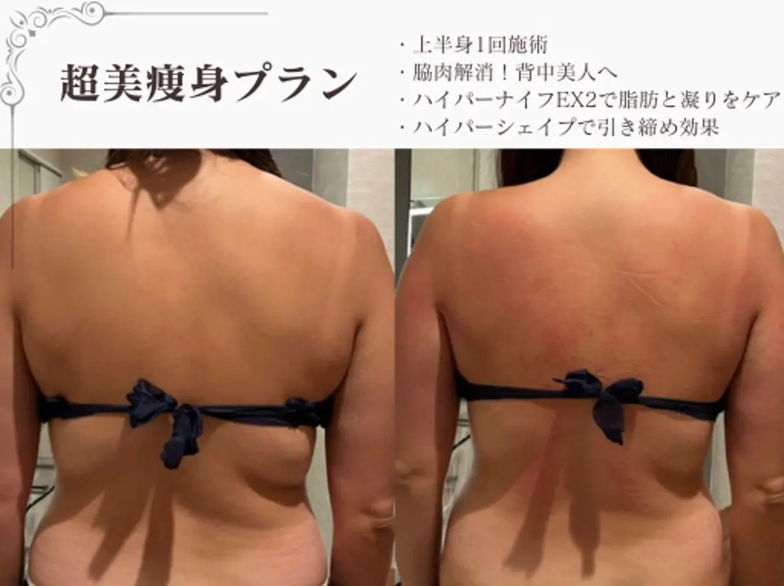 エステ リラク 総合美容サロン LOVEME渋谷本店のエステ・リラクイメージ