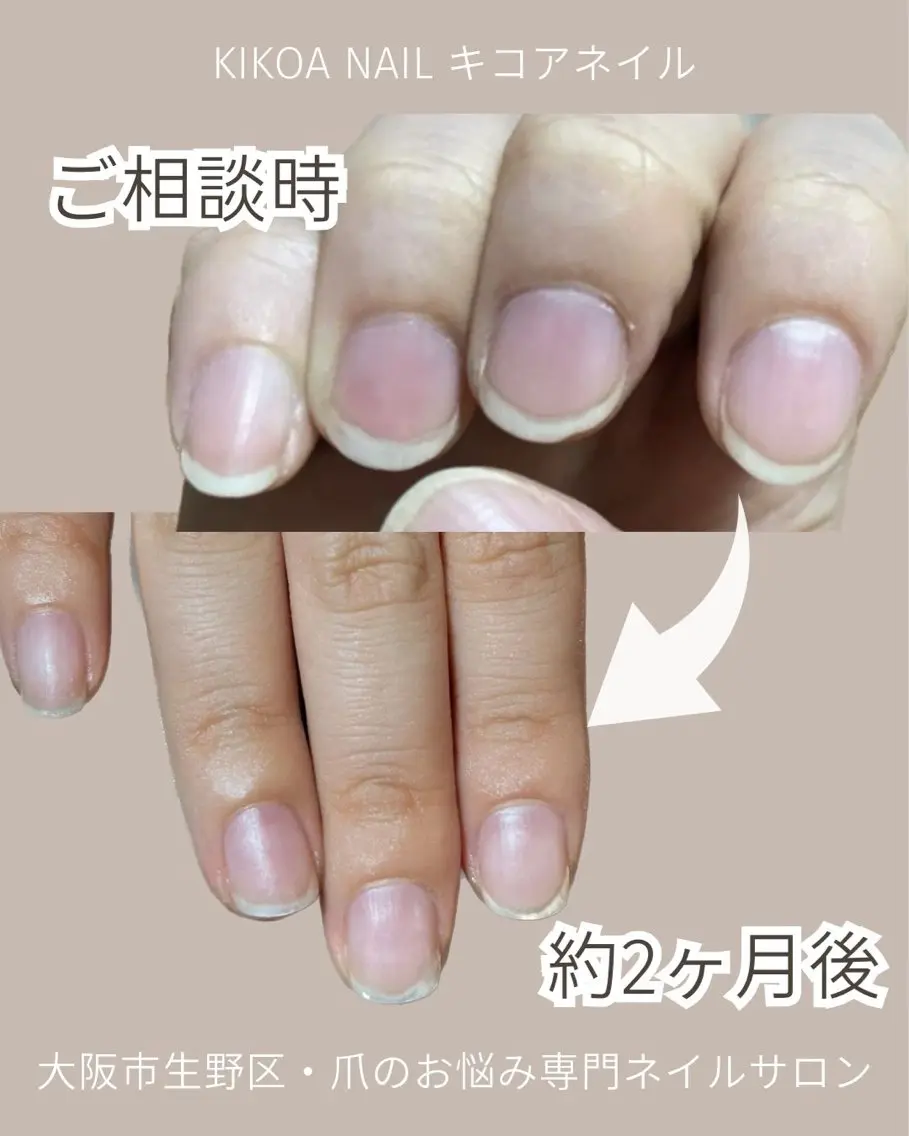 3回セット【最短3ヶ月で褒められる手に】自爪育成(2000円相当のｵｲﾙ付き)※ﾒﾝｽﾞ(男性)歓迎！.の写真