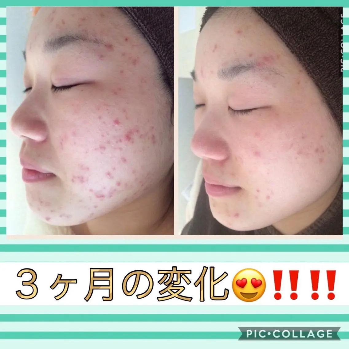 ミディアム カラー パーマ ヘアアレンジ メンズ キッズ ネイル マツエク・マツパ ニキビ・肌質改善専門 ♡人生が変わるサロンのエステ・リラクイメージ