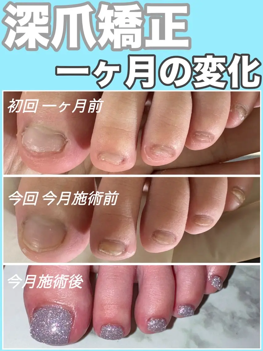 ネイル 卒業式 フットネイル nail salon petillantのネイルデザイン
