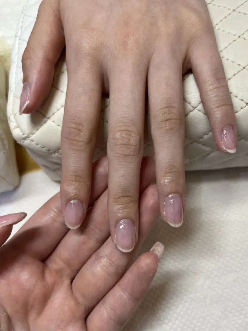 オフのみ(ケア込み)の写真