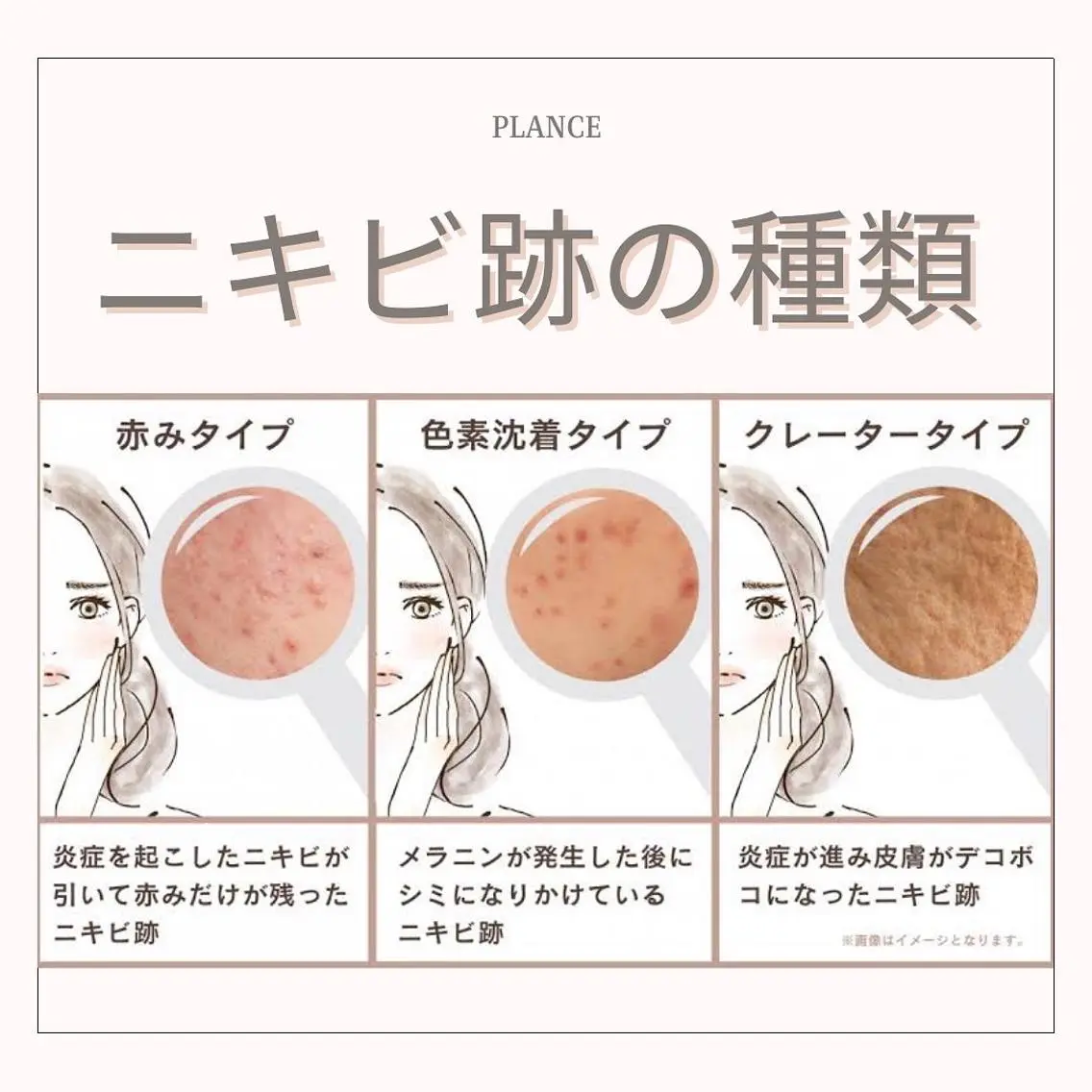 エステ フェイシャル専門 肌質改善/プランスのエステ・リラクイメージ