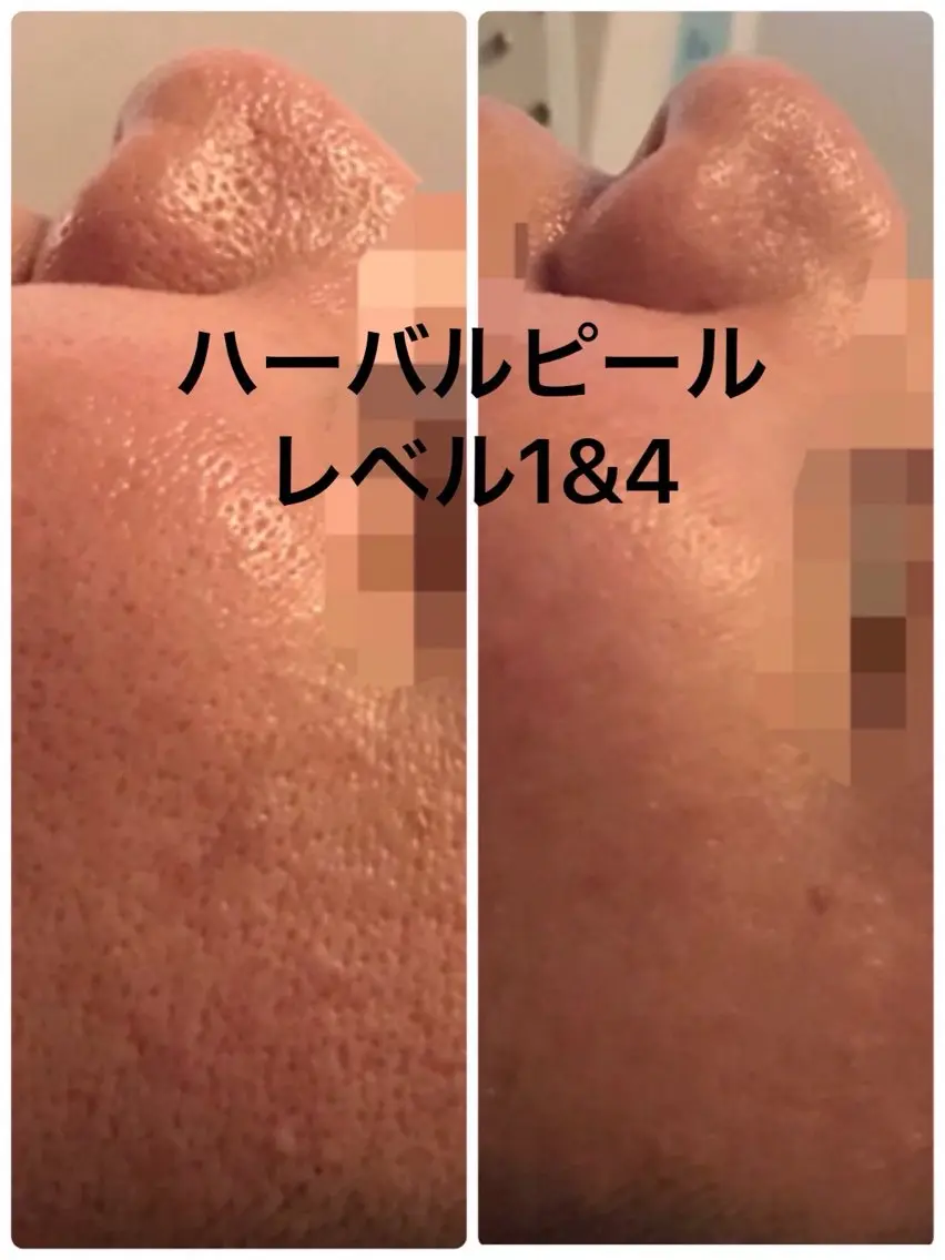エステ エステティック sala藤沢のエステ・リラクイメージ