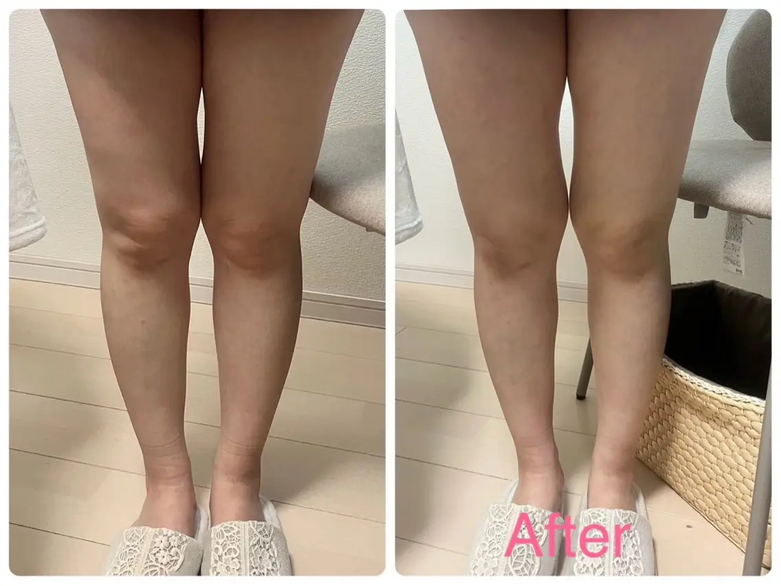 【冷え・むくみが気になる】 脚➕お腹リンパドレナージュの写真