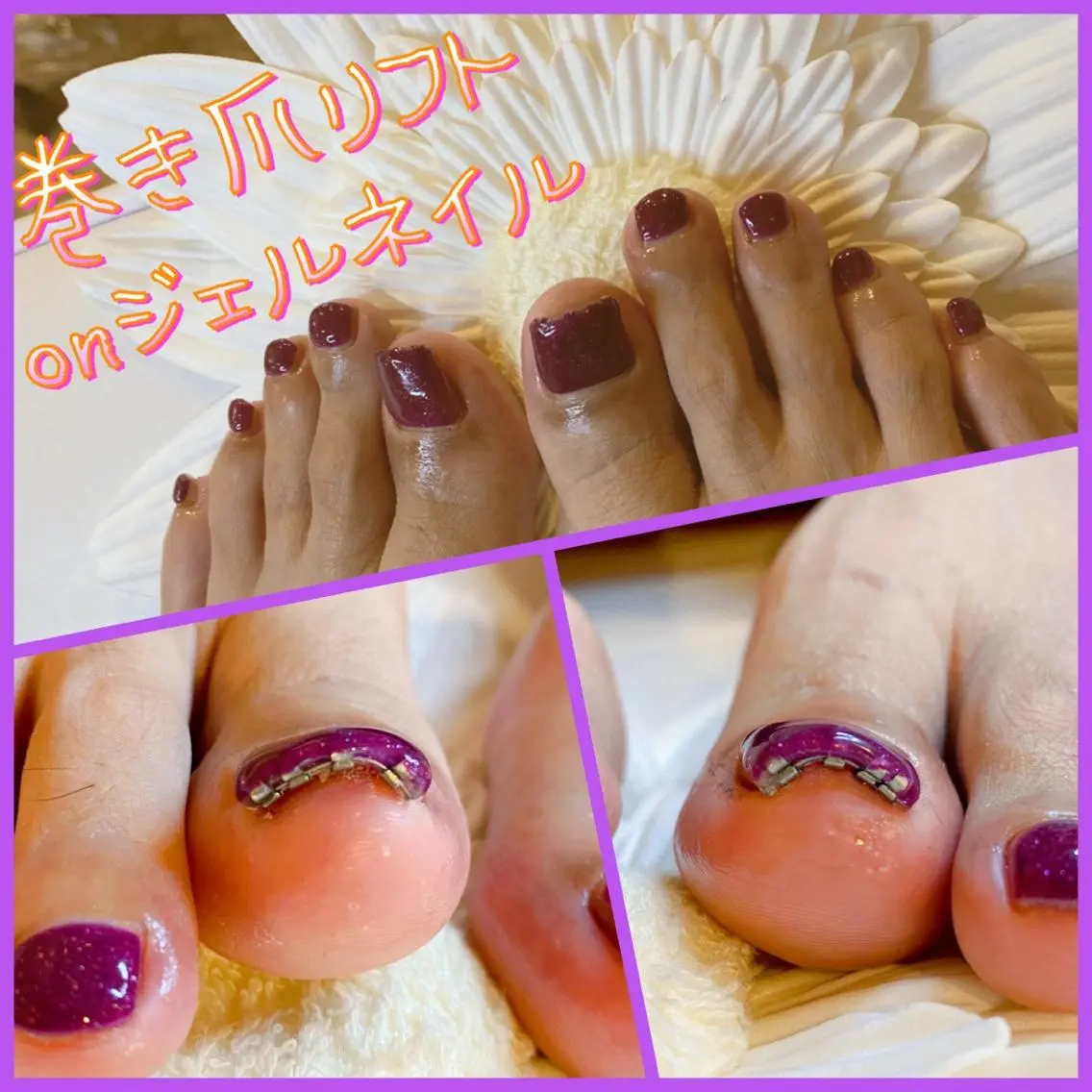 メンズ ネイル フットネイル 持ち込み 夏ネイル ♢ME2ROOM♢ #巻き爪#リラクのネイルデザイン