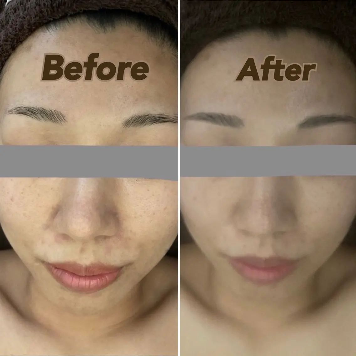 【お写真必須クーポン】フェイシャルエステのBefore After撮影にご協力いただける方へ☆お顔のリンパをお流し◎の写真